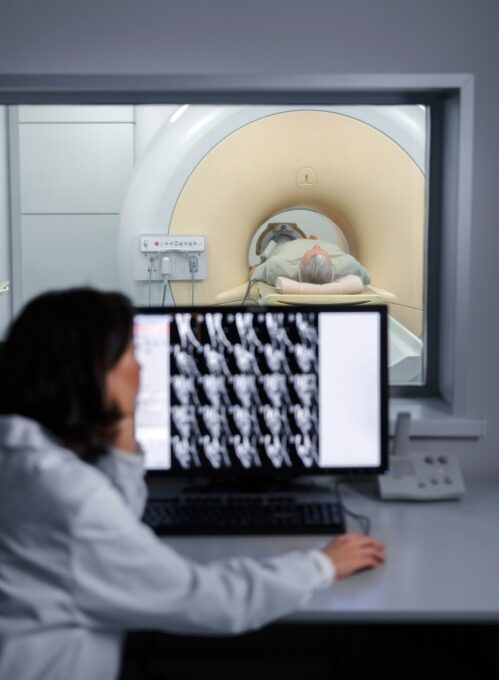 MRI Scan 500x721 (1)